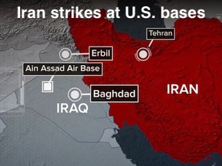حمله: پایگاه های آمریکا