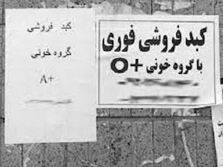 فروش اعضای بدن