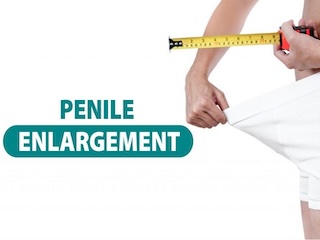 بزرگ کردن آلت